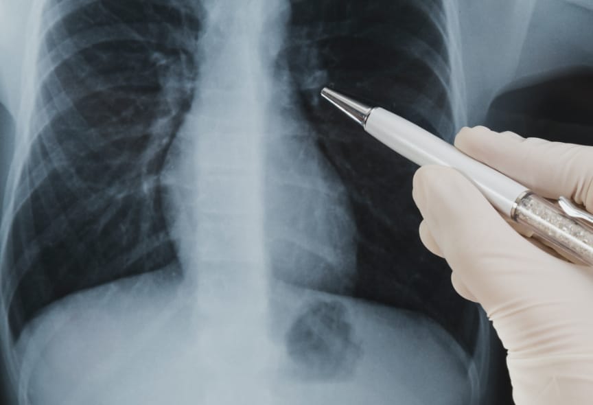 VUNO VUNO Med®-Chest X-ray™