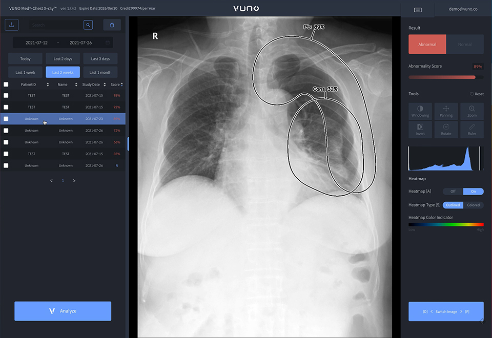 VUNO Med-Chest X-ray · PACS